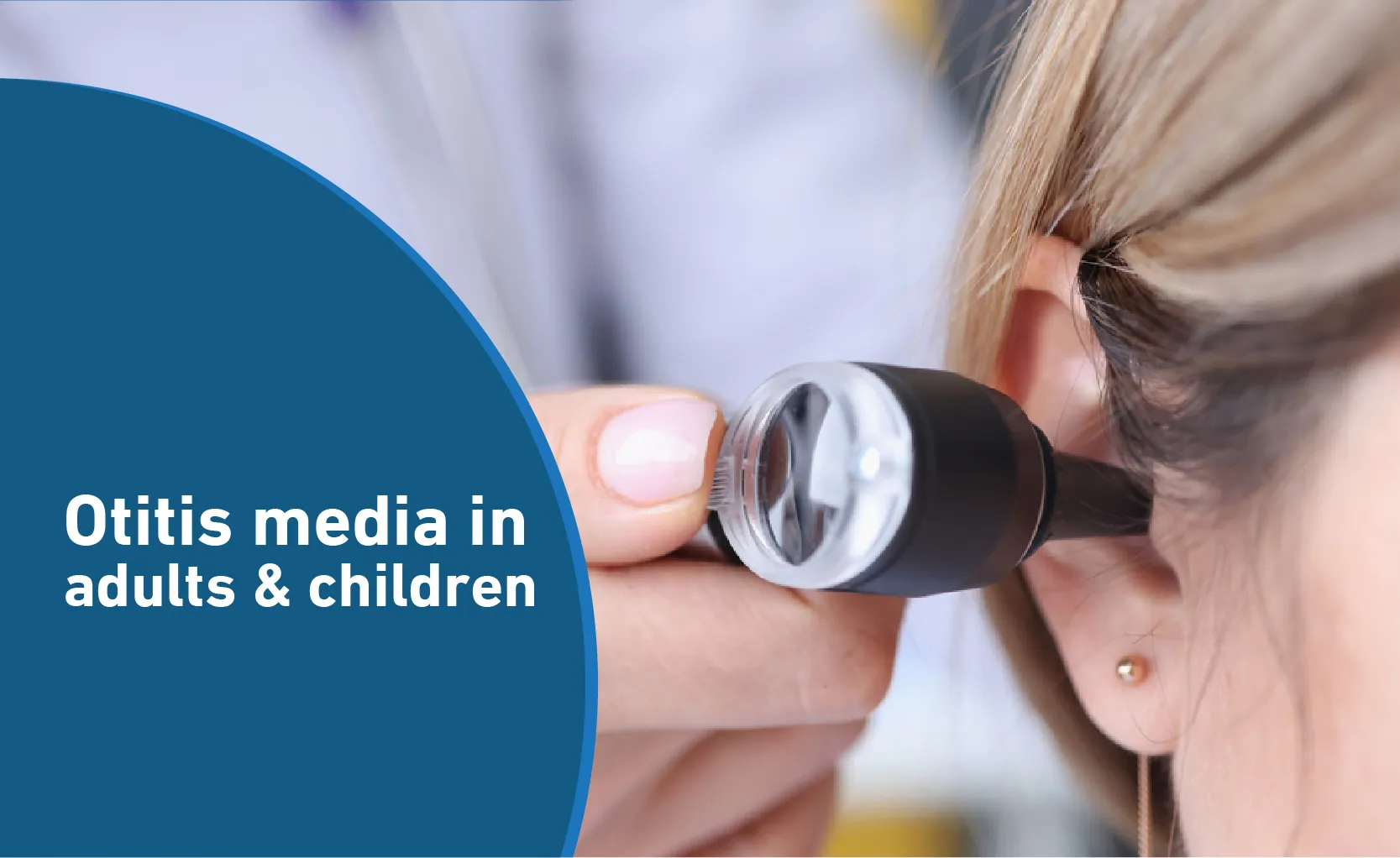 Everything you need to know about otitis media in children and adults